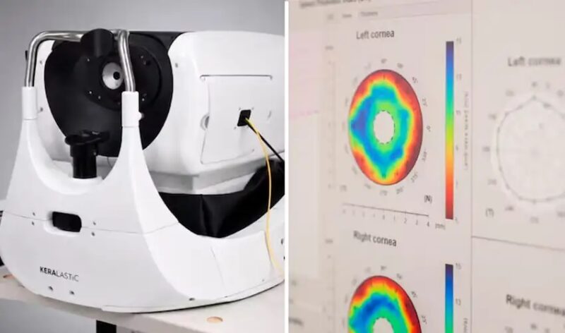 Más del 50% de peruanos con glaucoma no sabe que lo tiene: nueva tecnología busca evitar la ceguera